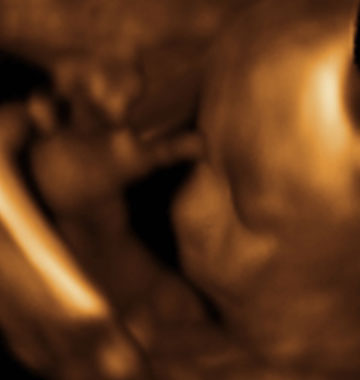 Baby #3's 3D Ultrasound 02