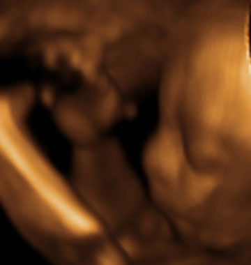 Baby #3's 3D Ultrasound 03