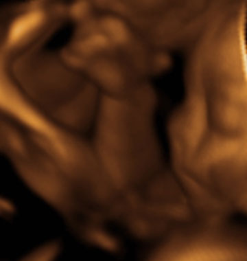 Baby #3's 3D Ultrasound 05