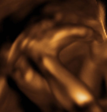 Baby #3's 3D Ultrasound 07