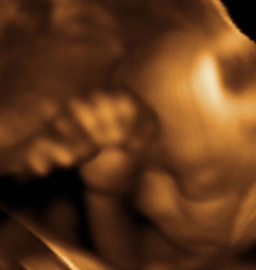 Baby #3's 3D Ultrasound 08