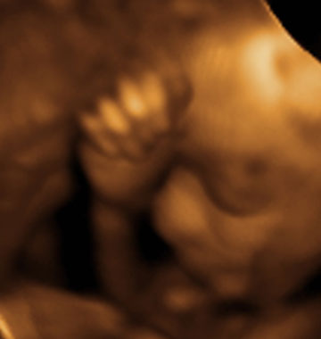 Baby #3's 3D Ultrasound 13