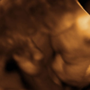 Baby #3's 3D Ultrasound 20