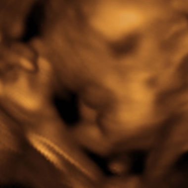 Baby #3's 3D Ultrasound 32