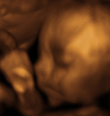 Baby #3's 3D Ultrasound 35