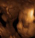 Baby #3's 3D Ultrasound 04