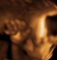 Baby #3's 3D Ultrasound 09