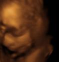 Baby #3's 3D Ultrasound 11