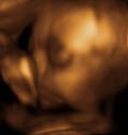 Baby #3's 3D Ultrasound 12