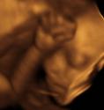 Baby #3's 3D Ultrasound 14