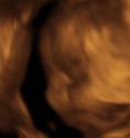 Baby #3's 3D Ultrasound 15