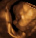 Baby #3's 3D Ultrasound 16