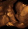 Baby #3's 3D Ultrasound 17
