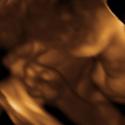 Baby #3's 3D Ultrasound 21