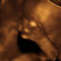 Baby #3's 3D Ultrasound 22