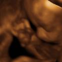 Baby #3's 3D Ultrasound 24