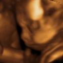 Baby #3's 3D Ultrasound 25