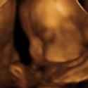 Baby #3's 3D Ultrasound 27