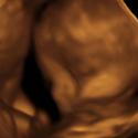 Baby #3's 3D Ultrasound 28