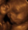 Baby #3's 3D Ultrasound 30