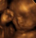 Baby #3's 3D Ultrasound 31