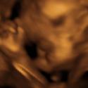 Baby #3's 3D Ultrasound 32
