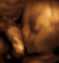 Baby #3's 3D Ultrasound 34